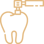 Polishing (stain Removal)