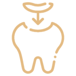 Semi-Permanent fillings