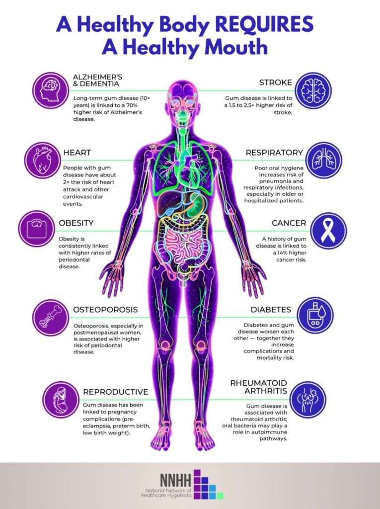 Healthy Body Requires Healthy Mouth